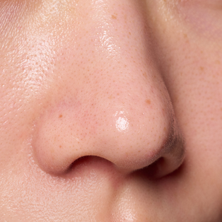 クレンジング前の毛穴汚れやざらつきが気になる小鼻周りの肌